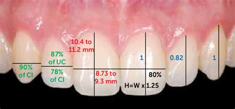 how to measure tooth size